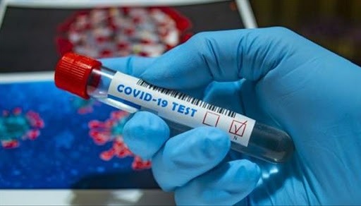 Kosova regjistron sot 22 të vdekur dhe 1,894 raste pozitive me koronavirus